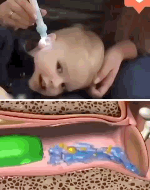 Limpiador De Oídos Succionador Eléctrico